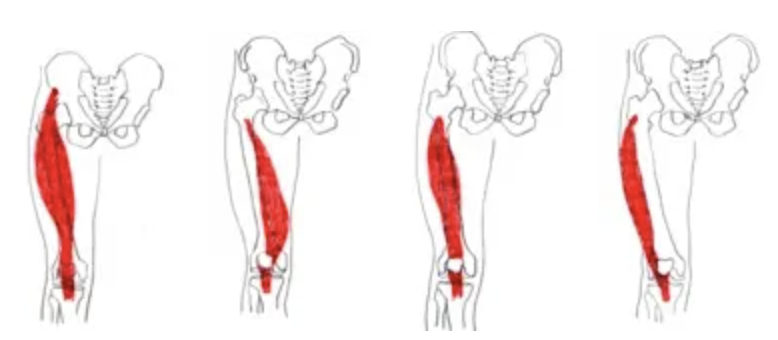 膝痛の筋肉